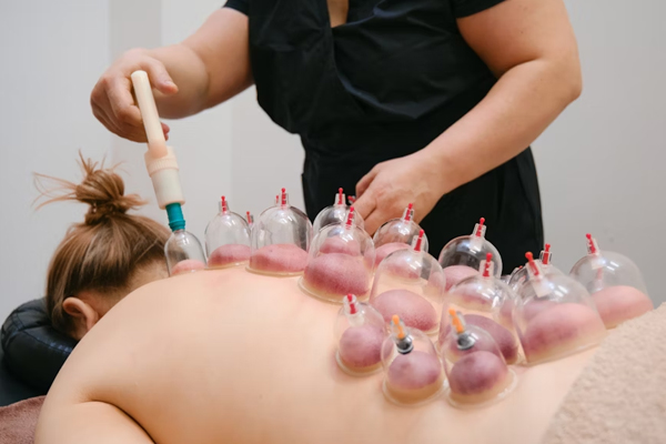 Cupping Therapy (Hijama) Services in Gurgaon