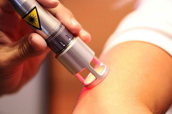 Laser Therapy